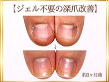 ステラルーテ(Stella lute)