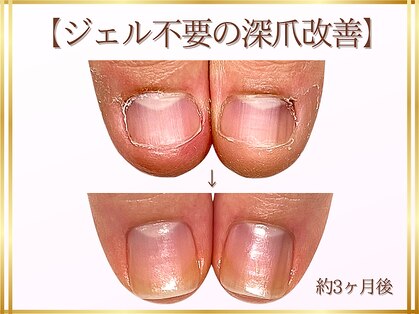 ステラルーテ(Stella lute)の写真