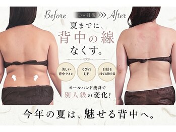 チル(Chill)の写真/【とにかく痩せたい方必見】ラジオ波/キャビテーション/ダイオード/骨盤矯正など豊富なメニューをご用意♪