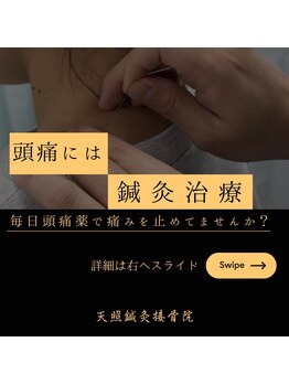 天照鍼灸接骨院/頭痛は鍼が圧倒的におススメ