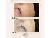 1回で透明感UP！根本的に肌質改善したい40代の方お待ちしてます