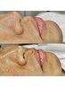 【お悩み眉＆お顔丸ごとケア】丸ごと垢抜けフルフェイスWAX <<人気急上昇中>>