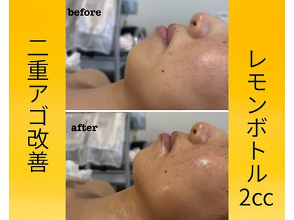 スーコ(SU:CO)の写真