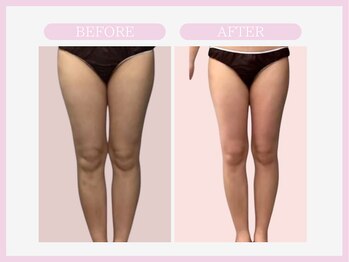 スリムライン 盛岡店(The Slim Line)/before→after