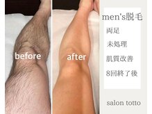 サロントット(salon totto)/before→after