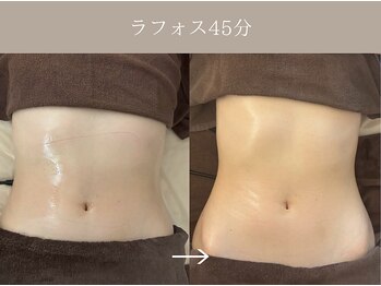 リィ プラス(Riii plus)/【ラフォスでくびれボディ】