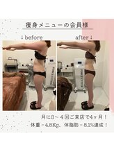 アンリール 旭川店(Anrire)/BODY施術のお客様です！