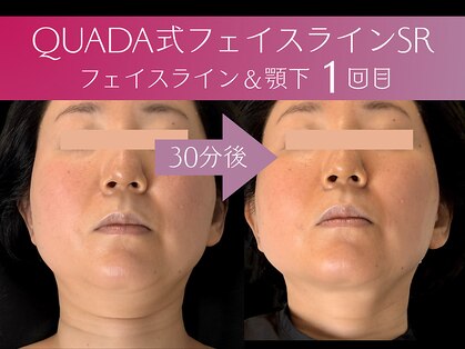 マイスター整体院 天神院の写真