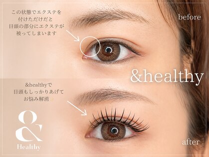 ルシアル(Rucial)の写真