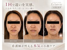 エクラヴィ(Eclatvie)
