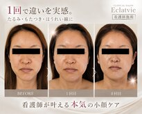 エクラヴィ(Eclatvie)
