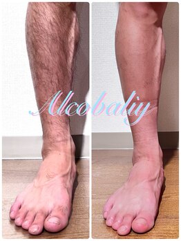 アルコバリー(Alcobaliy)/5回終了後です!結果出します!