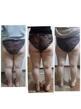 エアレ(eare)/下半身痩身