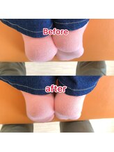 整体サロン佑/整体/beforeAfter