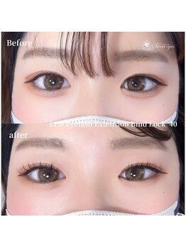 スウィートアイズ(Sweet eyes)/バインドロック40束