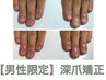 【深爪矯正男性限定】再発させない！バレずに深爪矯正お試し¥31,900→¥19,800