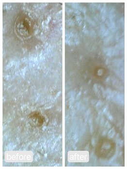 トランク(Trunk)/ハイドラ♪before→after