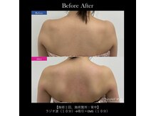 リュウヴィ(Ryuvi)の雰囲気（肩甲骨美人で後ろ姿にも自信を♪ブライダルにもオススメです！）