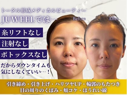 ユウェール(JUWEEL)の写真