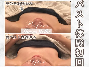 マリスステラ 天王寺(MarisStella)/体験からふっくらバスト♪