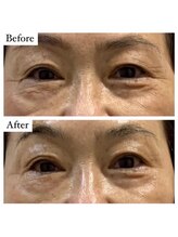 サロン アンス(anse)/ハーブピーリング