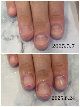 ネロリ(Neroli)/むしり爪