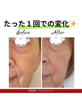 クリニカルココ 香椎店(クリニカルCOCO)/エイジングケアフェイシャル