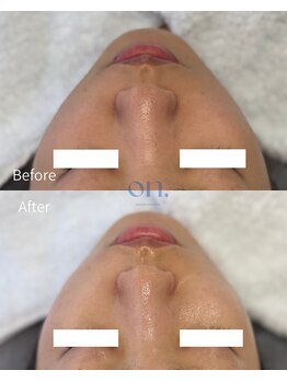 オン(on.)/うるツヤフェイシャルワックス