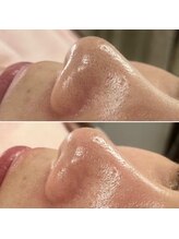 パッチ バイ サロンデヤンス(Patch by SALON DE YANSU)/