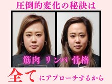 美容整体ナチュラル(natural)の雰囲気(顔だけでなく、全身からアプローチすると更に小顔に!)
