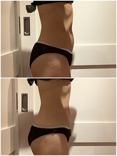 プリヴィエレジェ(privilegie)/