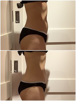 プリヴィエレジェ(privilegie)/