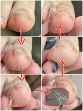 ヴィアンジュ 浦和コルソ店(Vie Ange)/BSフットケア