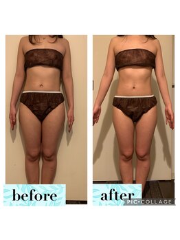 マンダ 田町(Manda)/お腹と足をスッキリ改善◎