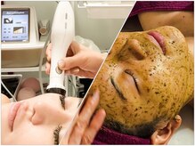 エステサロン ジジ 新宿(JIJI)/ハーブピーリング、プラズマ新宿