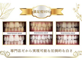 ホワイトニングショップ 所沢店