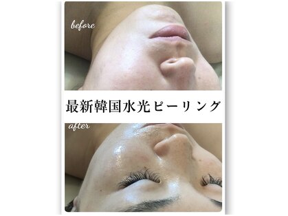 ビエタニティ(b.eternity)の写真