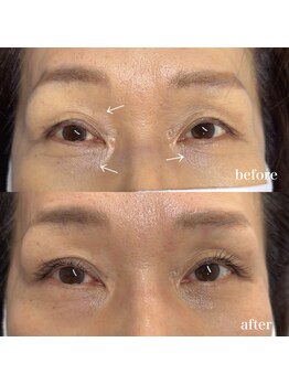 クレール(clair)/アイパワーエステ