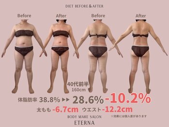 エテルナ(Eterna)/ダイエット大成功★