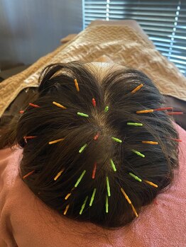 リノア鍼灸院(LINOA)の写真/白髪や髪の毛が細くなったお悩みへ。頭皮ケアで艶髪を育み毛量不足や抜け毛のケアをサポート！◎