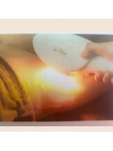 エヌーサ(Enoosa)/☆話題の美肌脱毛☆　　　