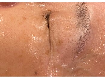 セブンシーズ 上野店(Seven Seas)/【施術後】50代後半の女性の目元