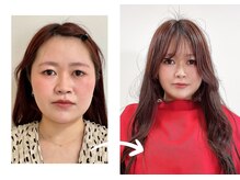 エピファニー 東京 銀座/ビフォーアフター20代（Y.O様）