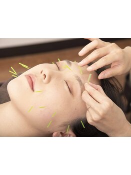 鍼灸施術を受けたい