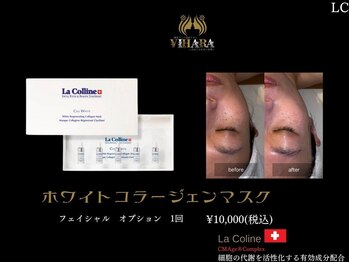 ビハーラ 門司店/ホワイトニングフェイシャル