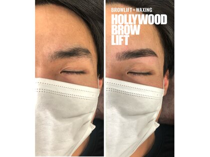 脱毛専門店 美的の写真