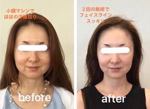 アンベリ(Embelli)