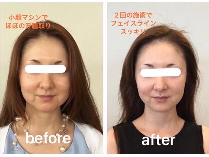 アンベリ(Embelli)の写真