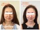 アンベリ(Embelli)の写真