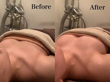 ジェイオー(J.O)/バストアップコルギ/小顔コルギ